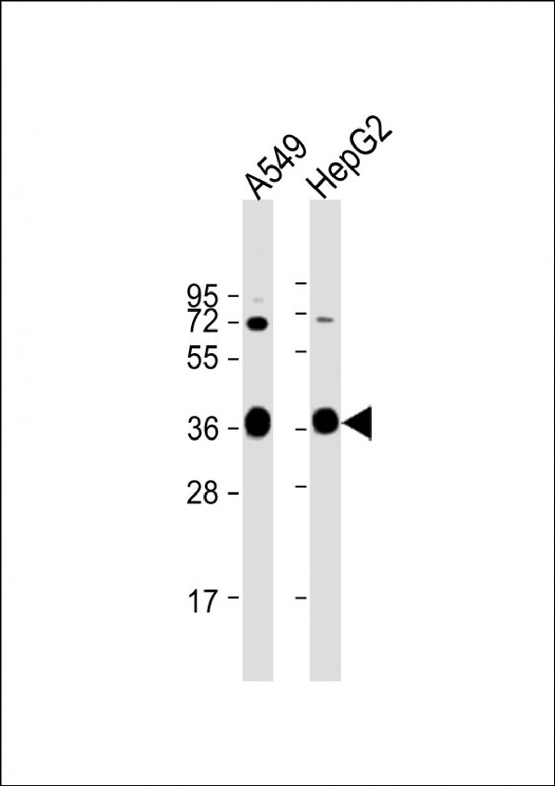 Western Blot at 1:1000 dilution Lane 1: A549 whole cell lysate Lane 2: HepG2 whole cell lysate Lysates/proteins at 20 ug per lane.