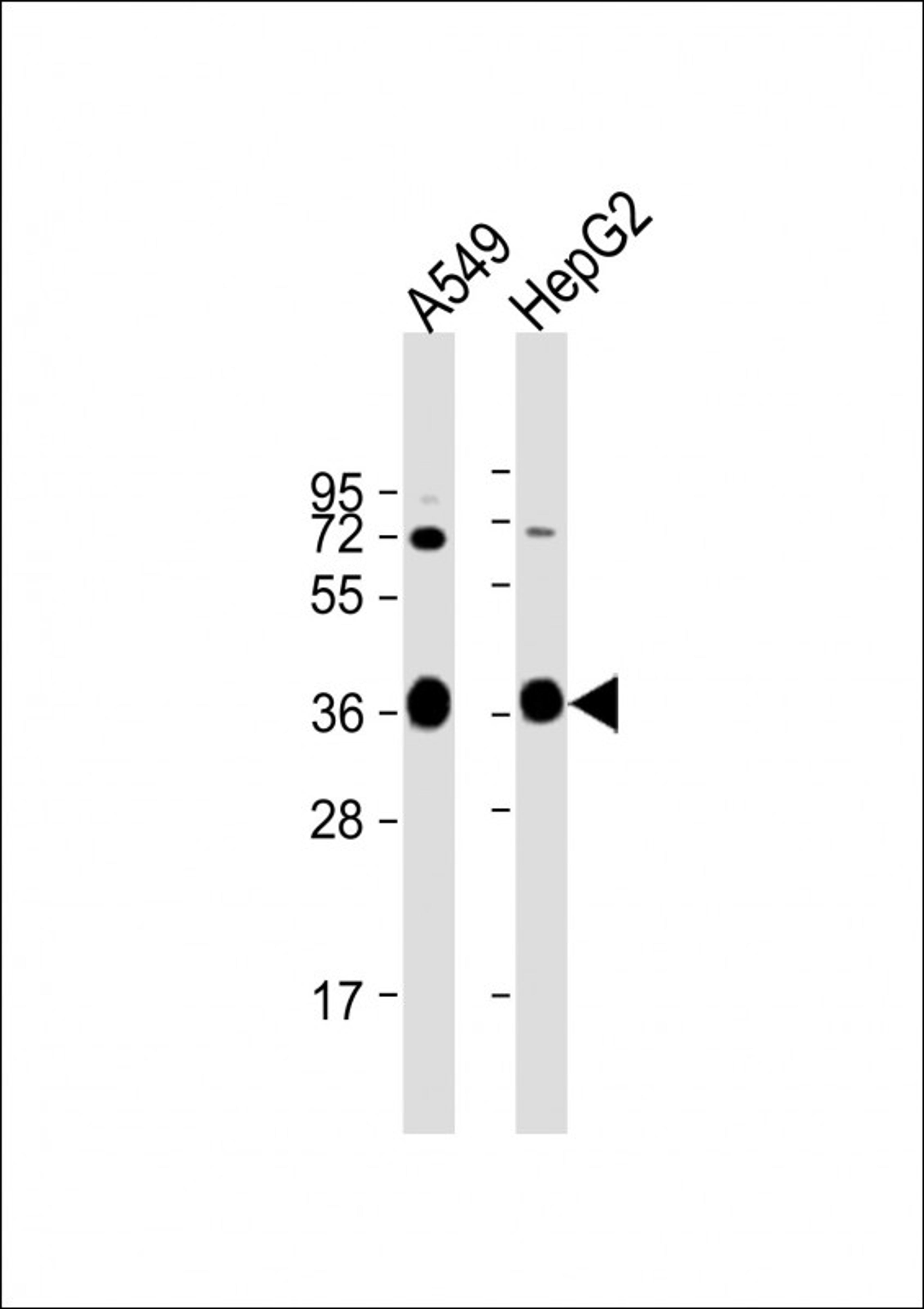 Western Blot at 1:1000 dilution Lane 1: A549 whole cell lysate Lane 2: HepG2 whole cell lysate Lysates/proteins at 20 ug per lane.