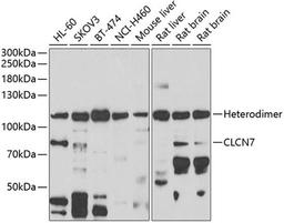 Western blot - CLCN7 antibody (A6886)