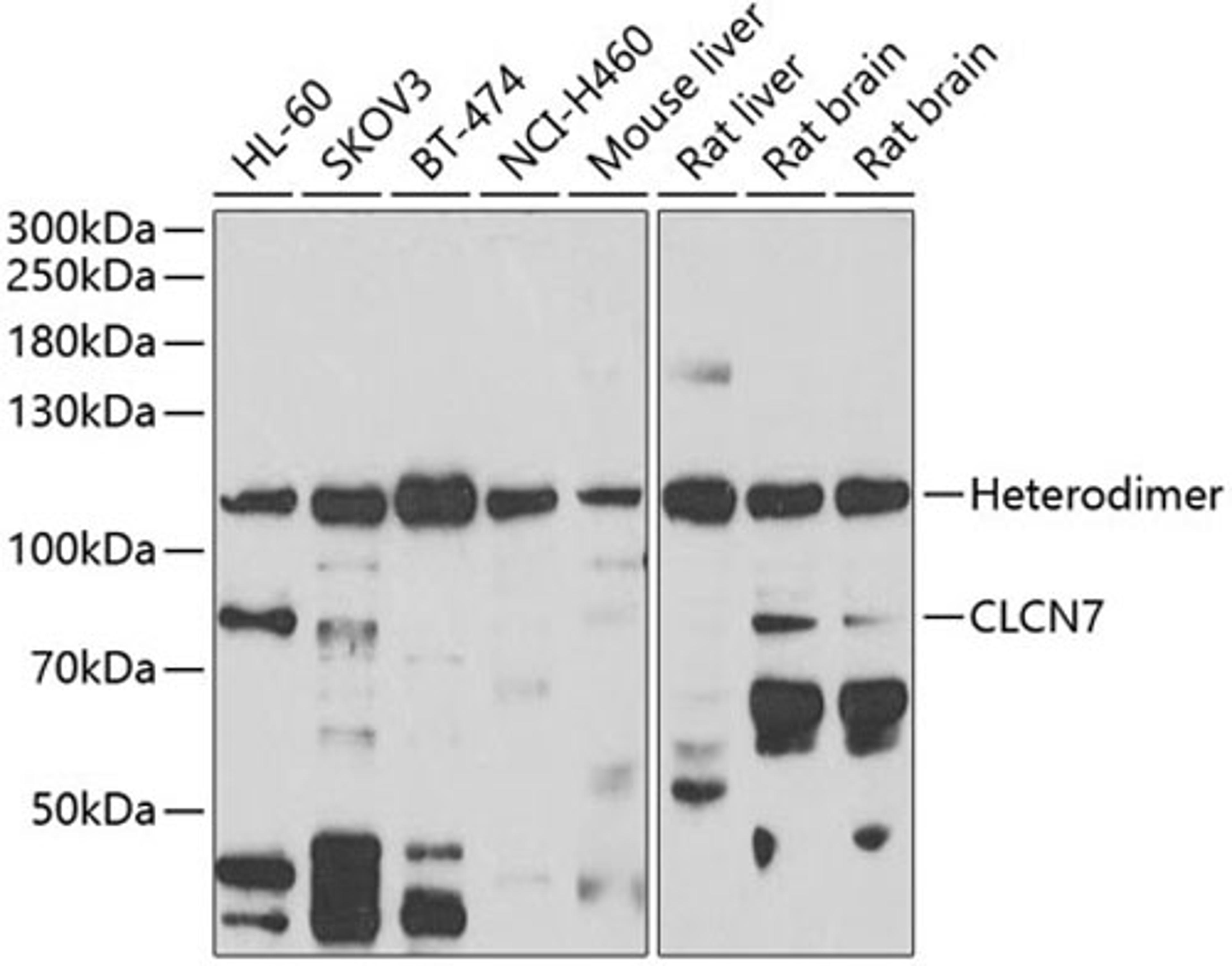 Western blot - CLCN7 antibody (A6886)