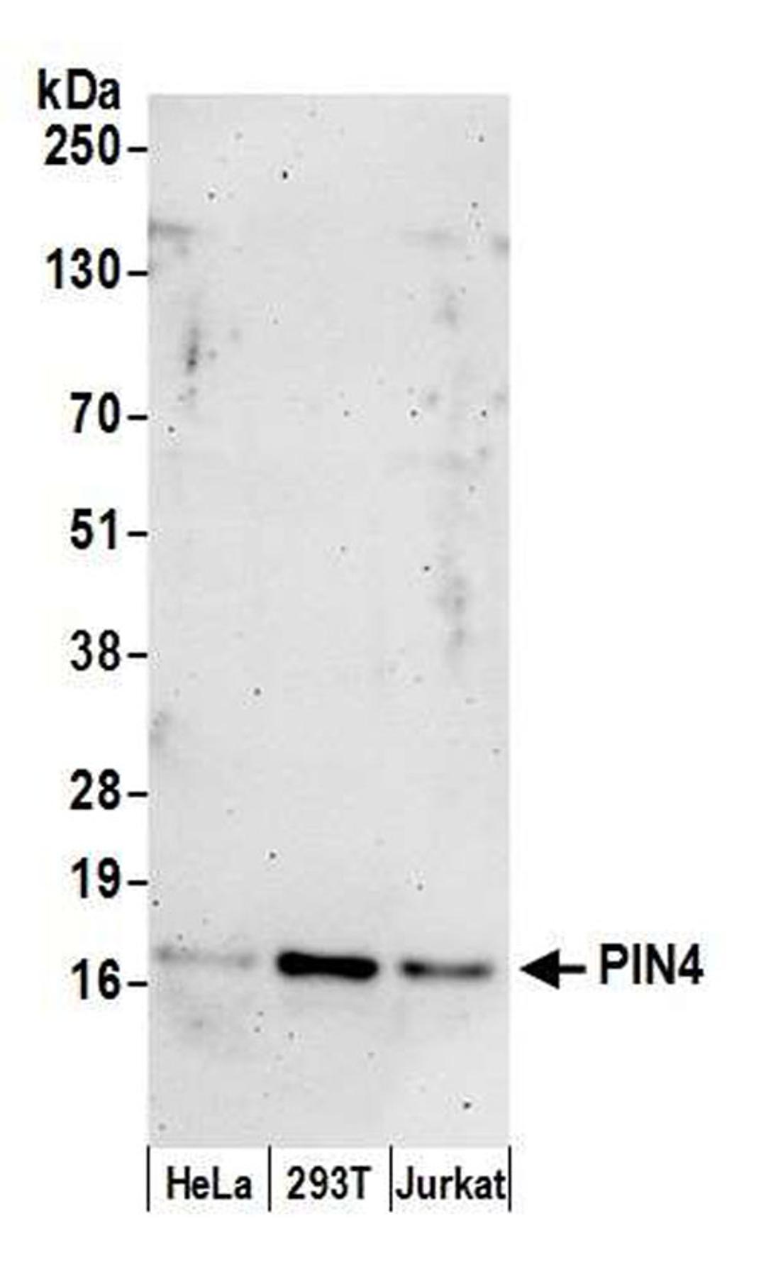 Detection of human PIN4 by WB.