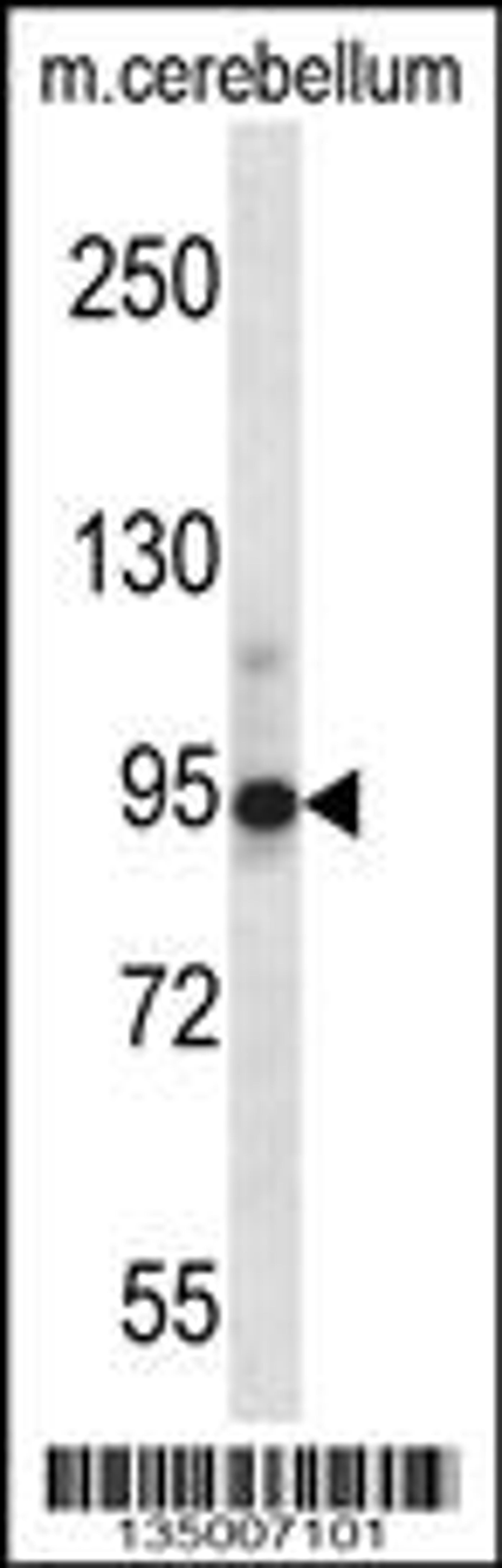 Western blot analysis in mouse cerebellum tissue lysates (35ug/lane).