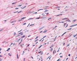 Immunohistochemistry-Paraffin: Muscarinic Acetylcholine Receptor M3/CHRM3 Antibody [NLS5259] - Analysis of anti-CHRM3 / M3 antibody with NLS 5259 on human hyper-plastic smooth muscle.