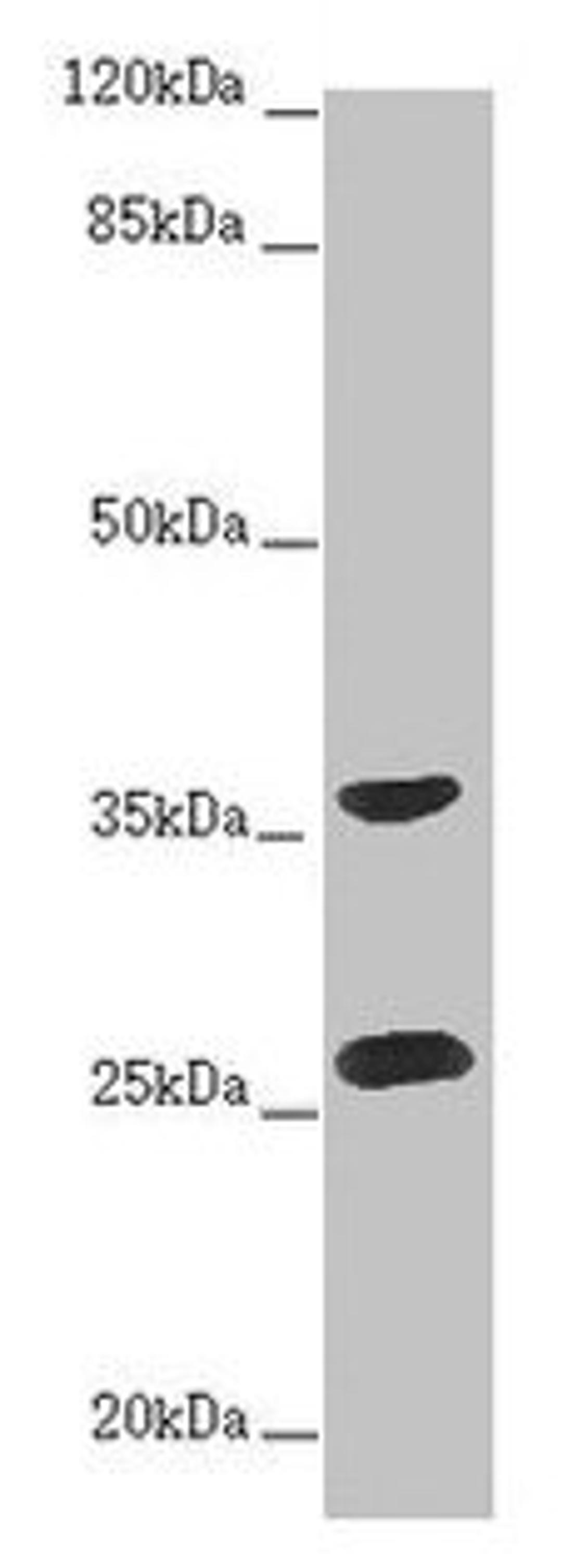 Western blot. All lanes: RAB12 antibody at 2ug/ml + Hela whole cell lysate. Secondary. Goat polyclonal to rabbit IgG at 1/10000 dilution. Predicted band size: 28 kDa. Observed band size: 28, 36 kDa.