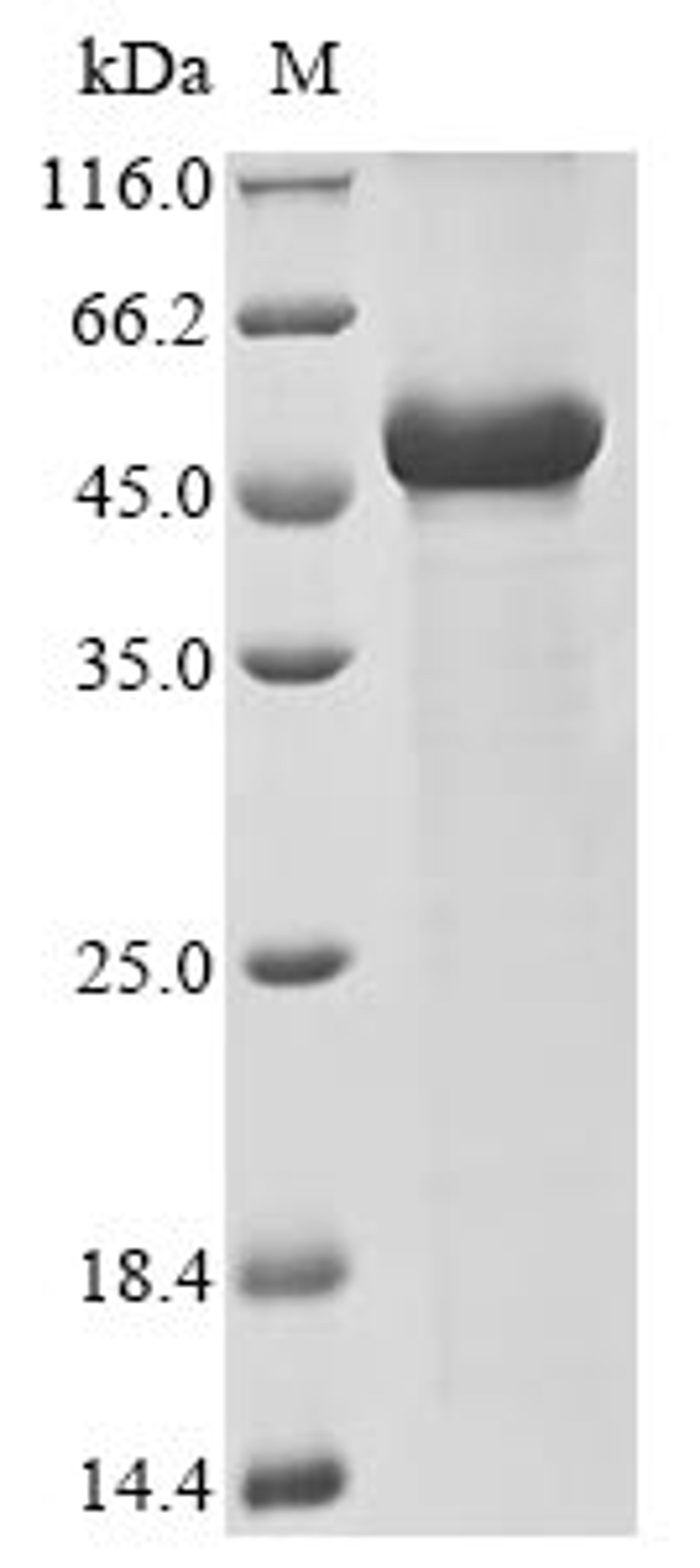 (Tris-Glycine gel) Discontinuous SDS-PAGE (reduced) with 5% enrichment gel and 15% separation gel.