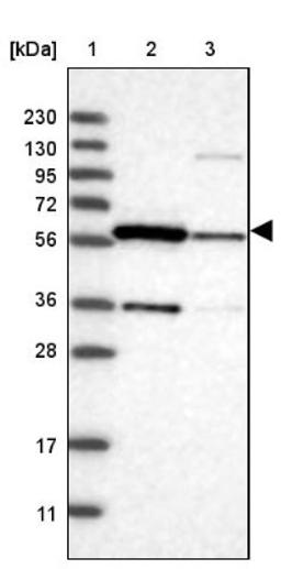 Western Blot: DYRK2 Antibody [NBP1-89516] - Lane 1: Marker [kDa] 230, 130, 95, 72, 56, 36, 28, 17, 11<br/>Lane 2: Human cell line RT-4<br/>Lane 3: Human cell line U-251MG sp