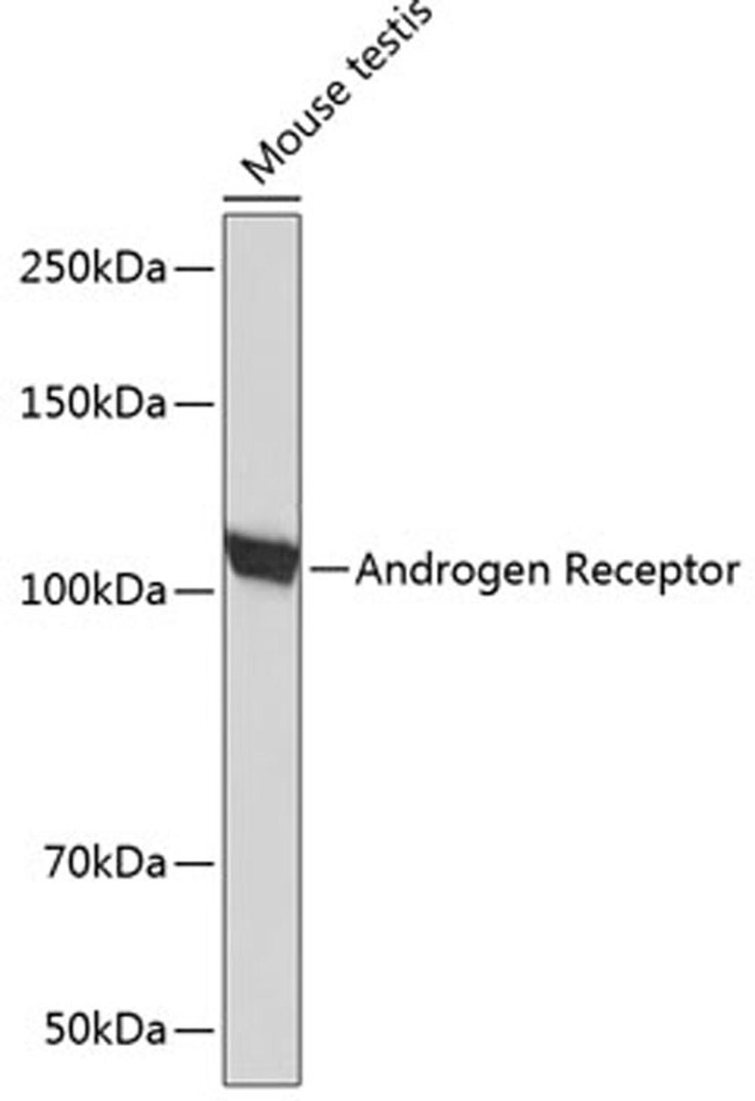 Western blot - Androgen Receptor antibody (A19611)