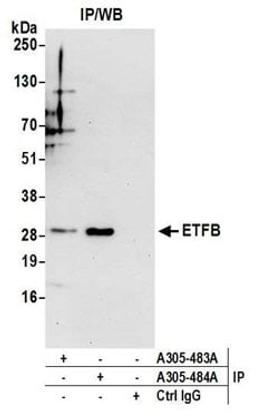 Detection of human ETFB by western blot of immunoprecipitates.