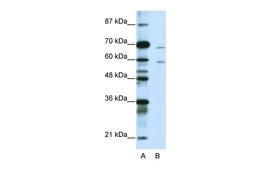 Antibody used in WB on Human Jurkat 1.25 ug/ml.