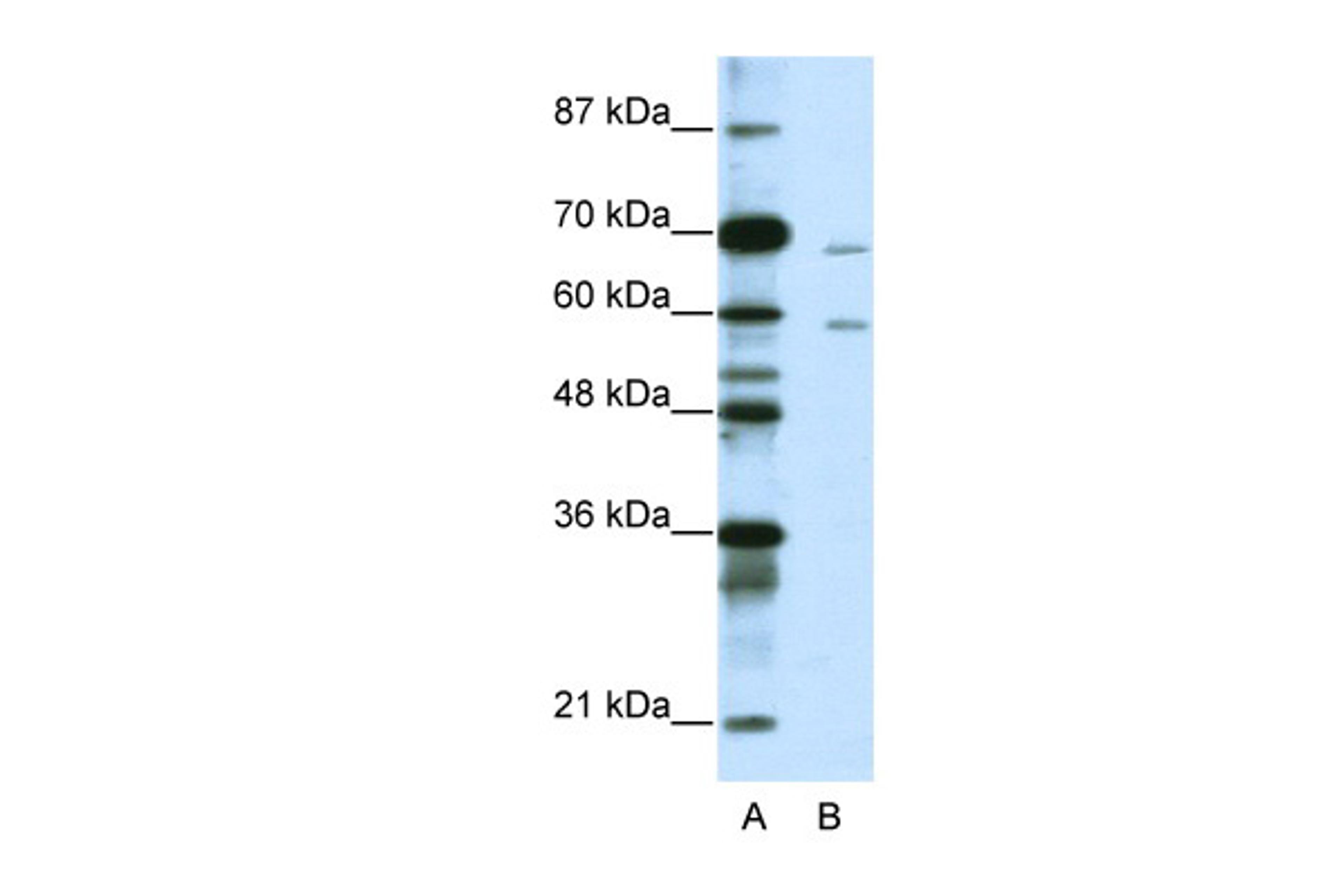 Antibody used in WB on Human Jurkat 1.25 ug/ml.