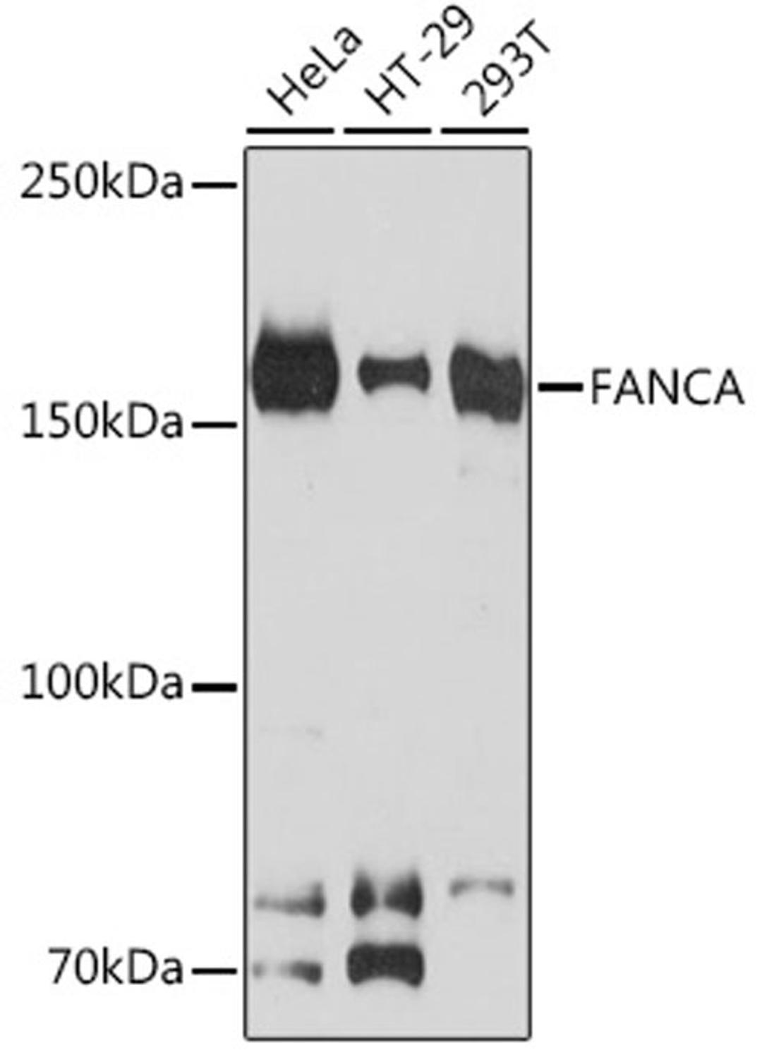 Western blot - FANCA Rabbit mAb (A9529)