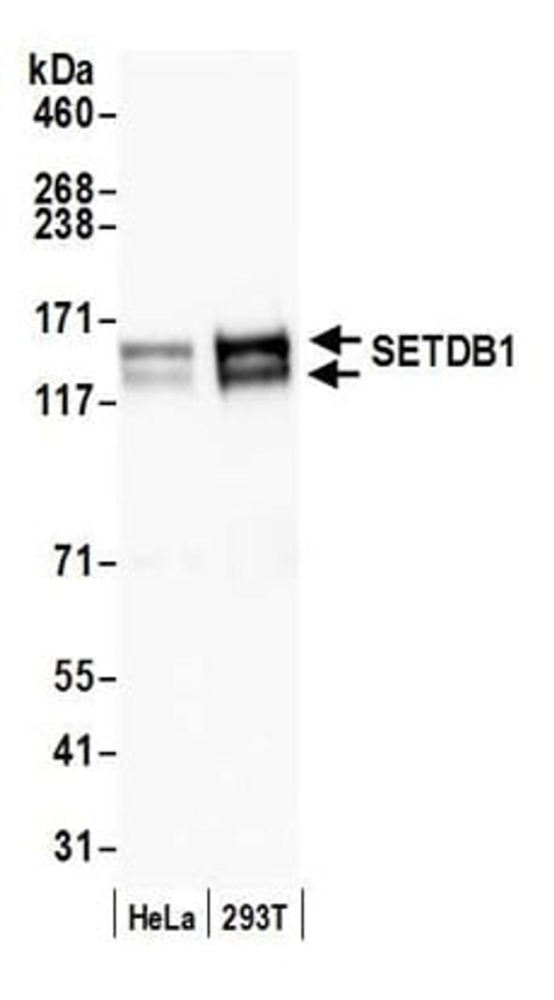 Detection of human SETDB1 by western blot.