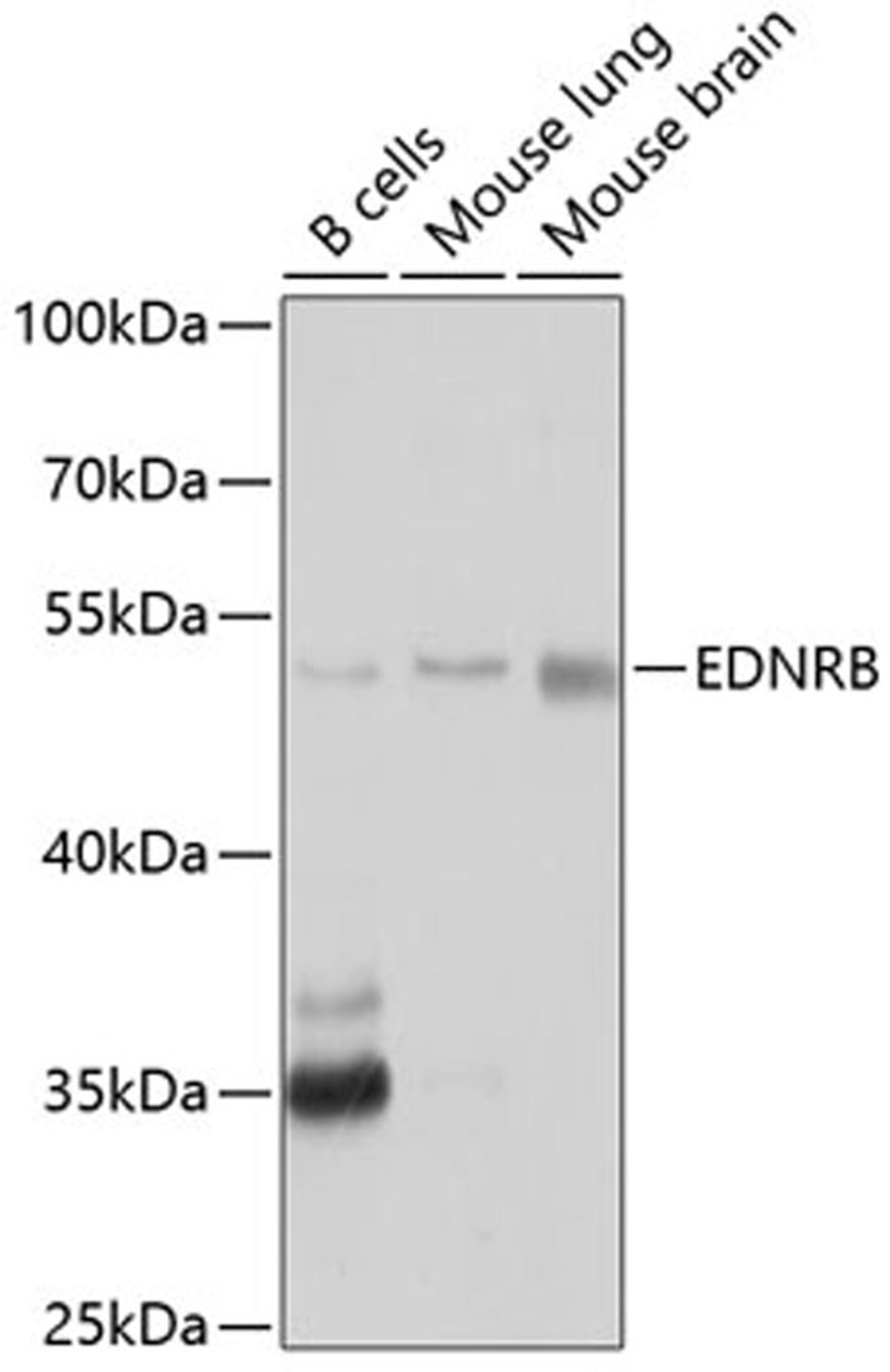 Western blot - EDNRB antibody (A2908)