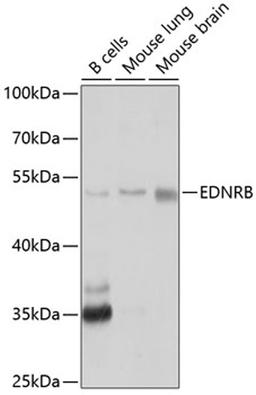 Western blot - EDNRB antibody (A2908)