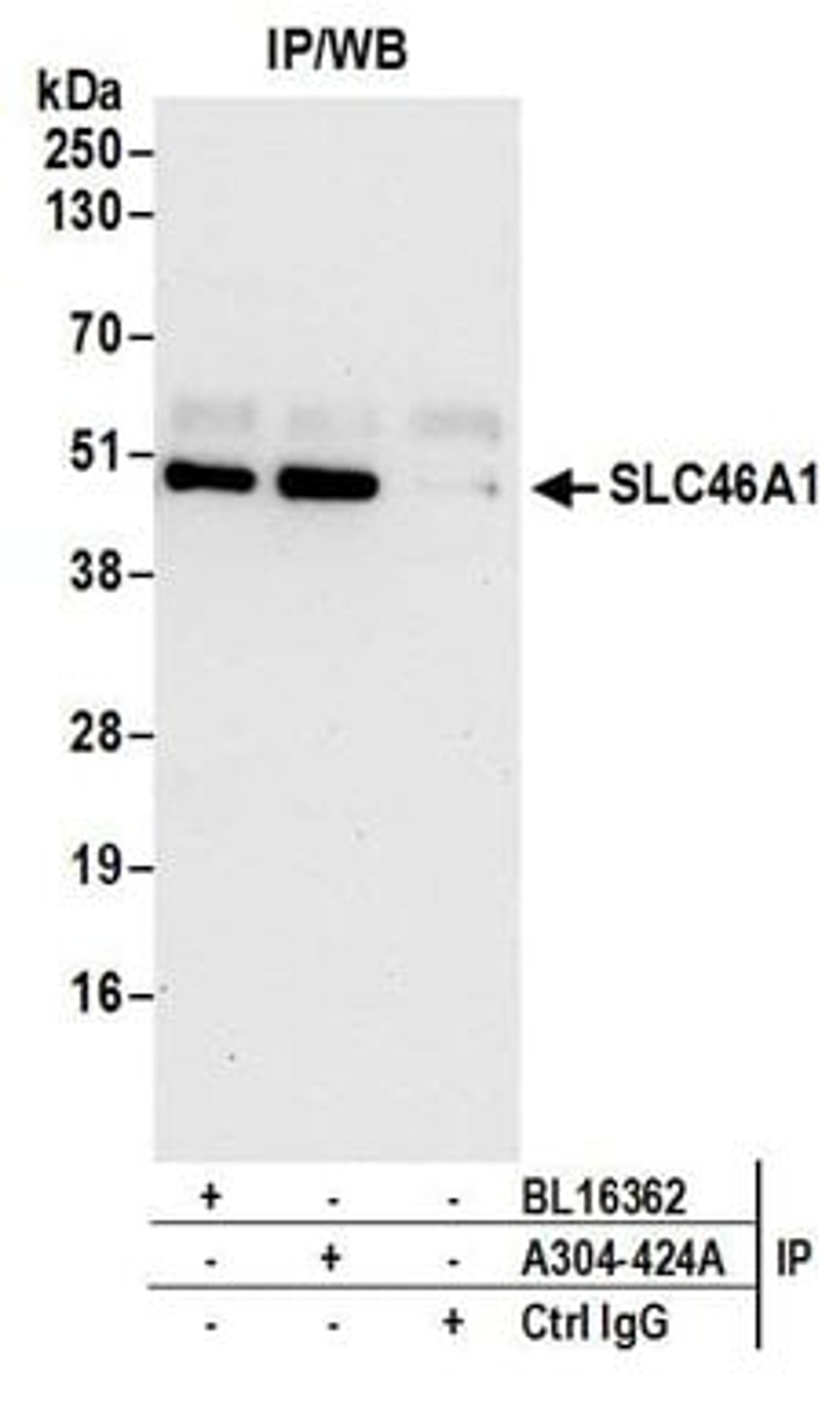 Detection of human SLC46A1 by western blot of immunoprecipitates.