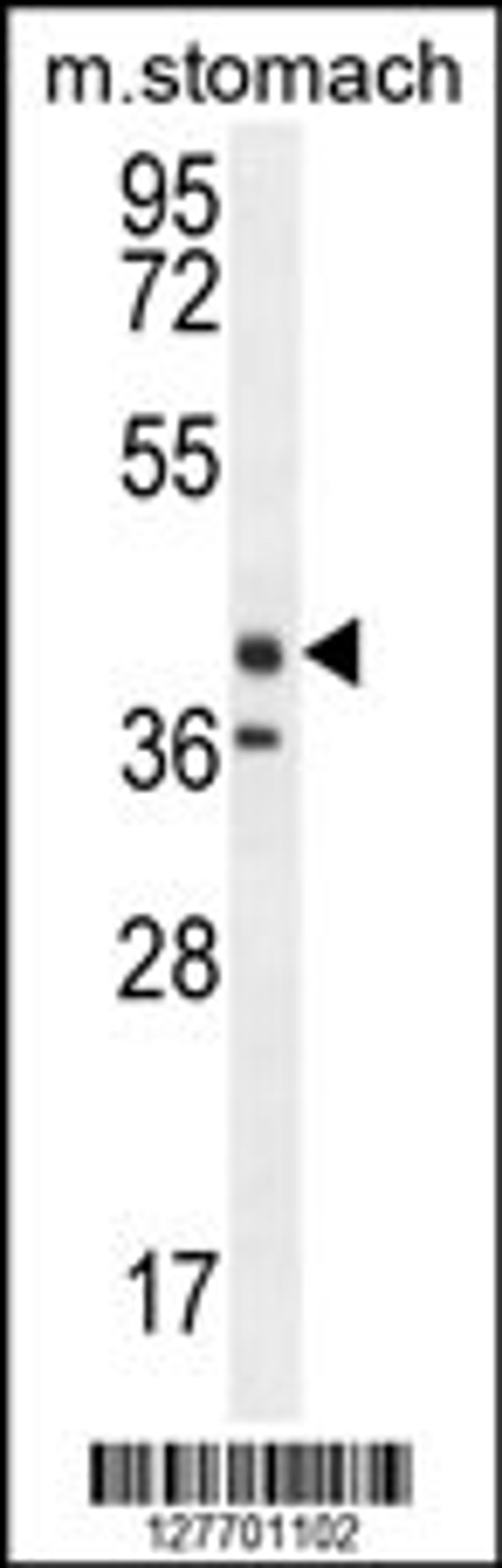 Western blot analysis in mouse stomach tissue lysates (35ug/lane).This demonstrates thedetected the EKI2 protein (arrow).