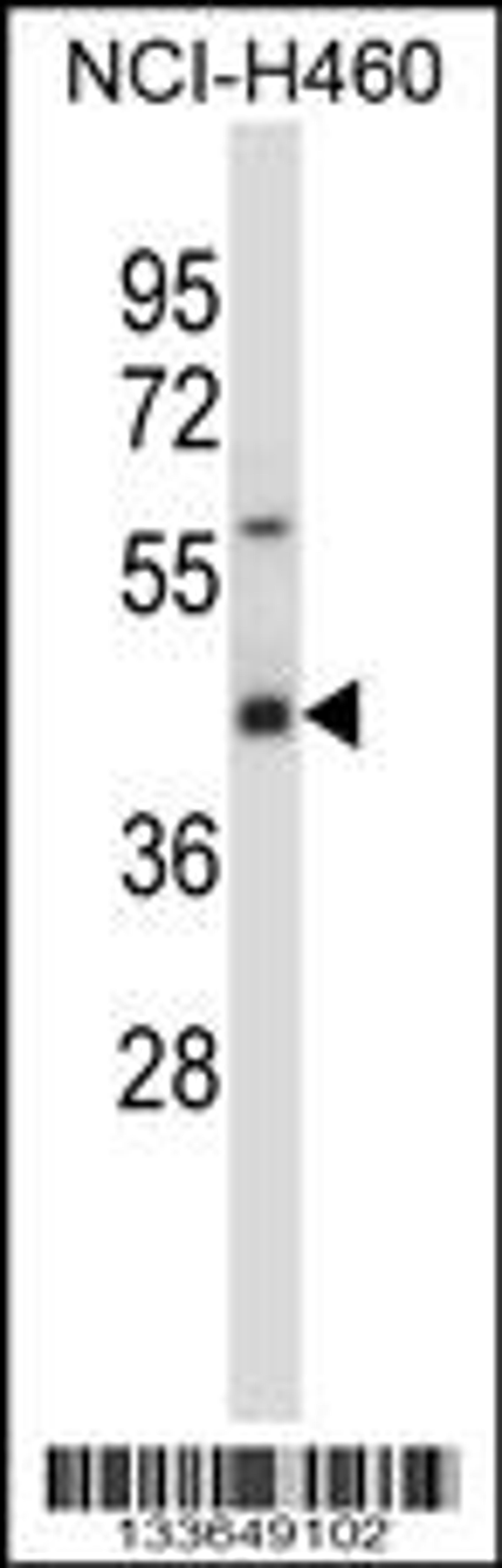 Western blot analysis in NCI-H460 cell line lysates (35ug/lane).