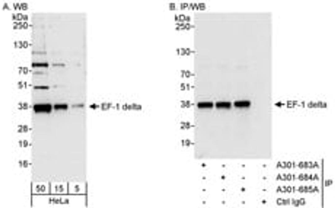 Detection of human EF-1 delta by western blot and immunoprecipitation.