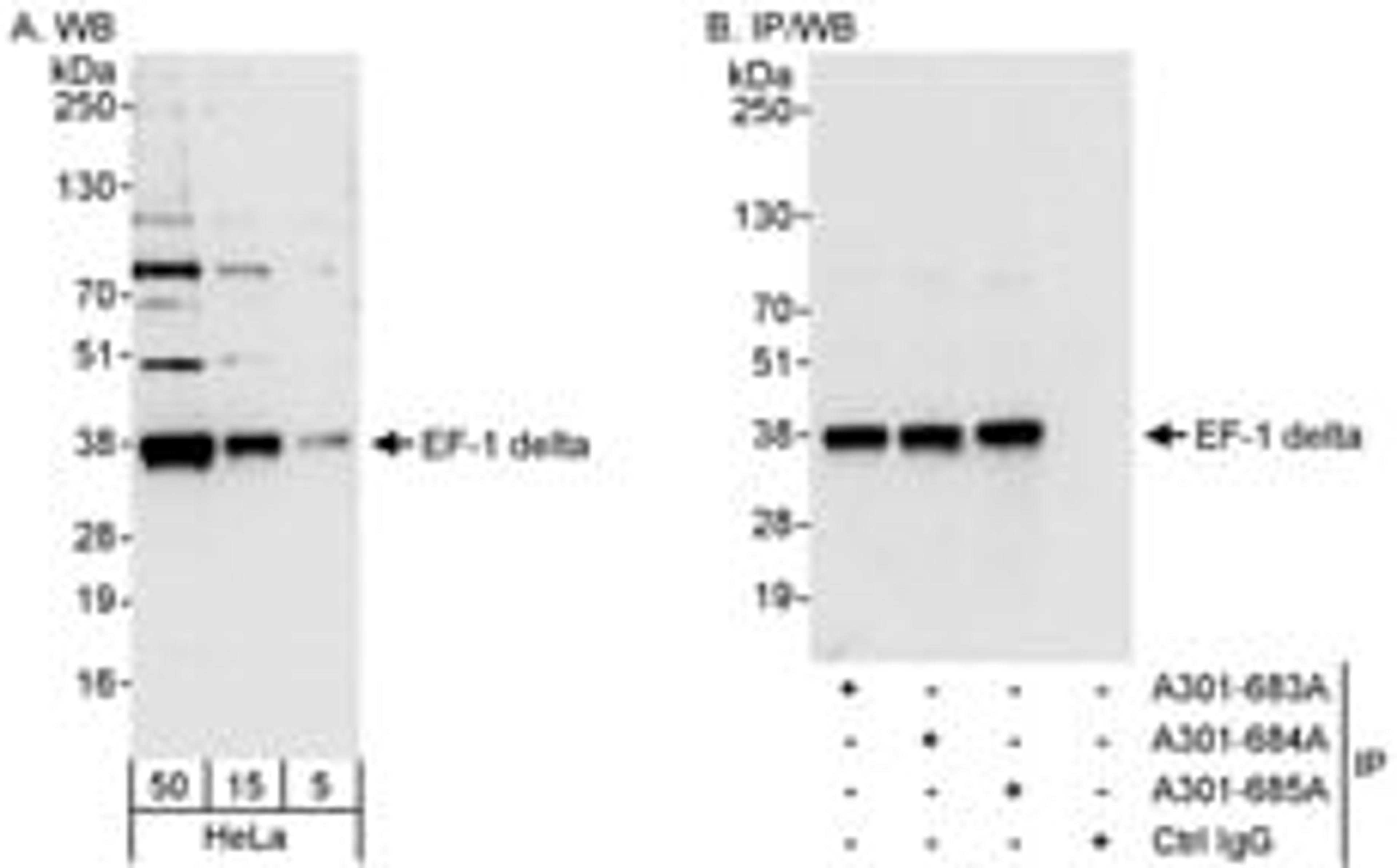 Detection of human EF-1 delta by western blot and immunoprecipitation.