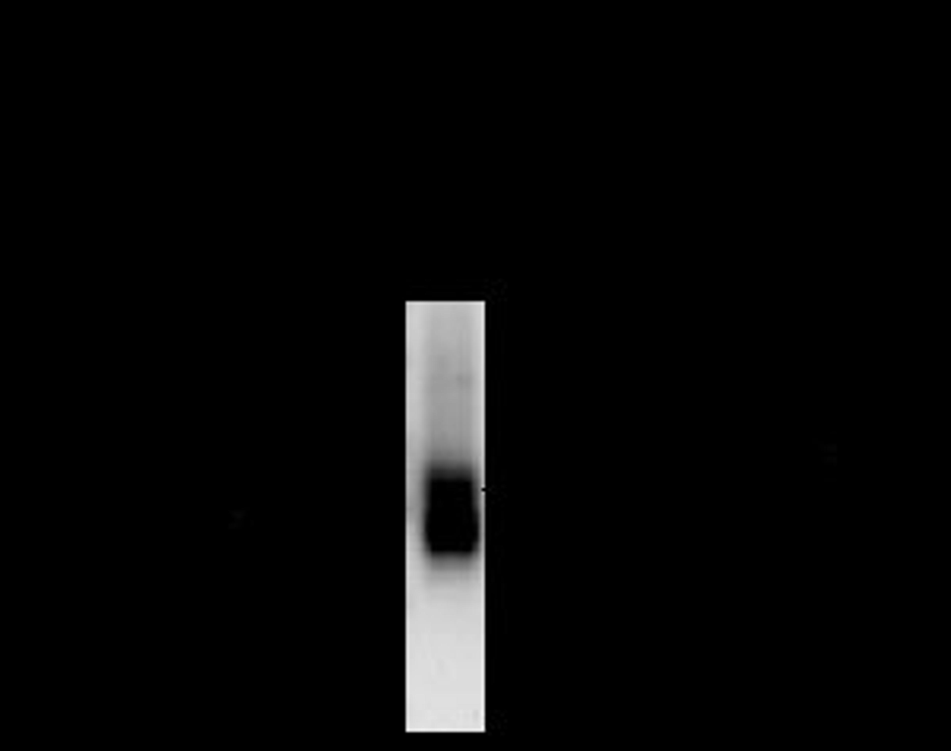 GABA A Receptor beta 2, CT Antibody