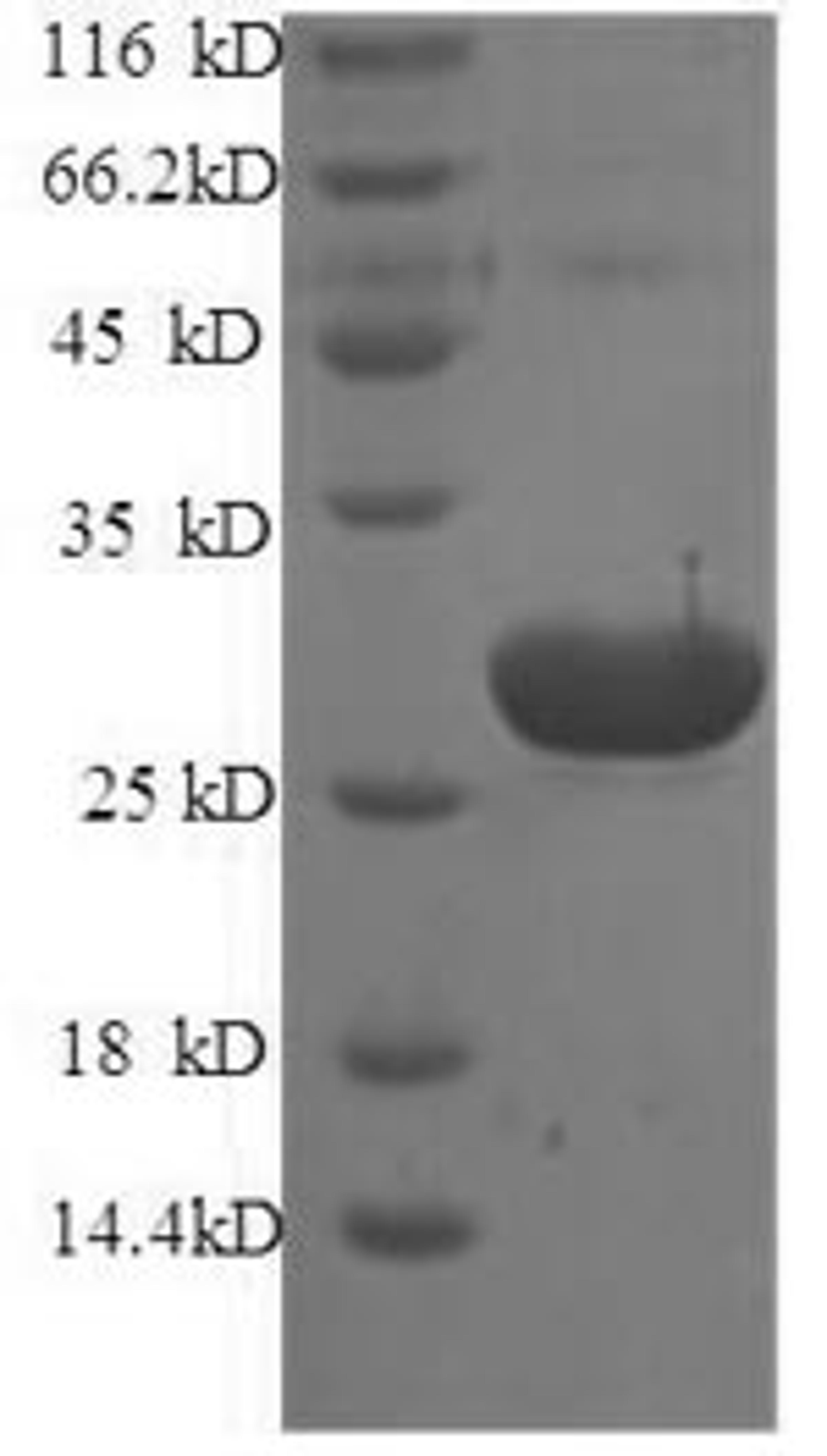 (Tris-Glycine gel) Discontinuous SDS-PAGE (reduced) with 5% enrichment gel and 15% separation gel.