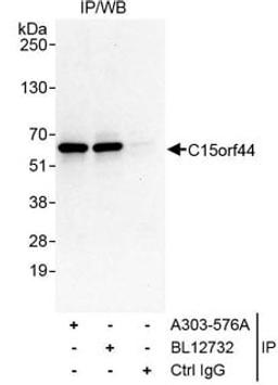 Detection of human C15orf44 by western blot of immunoprecipitates.