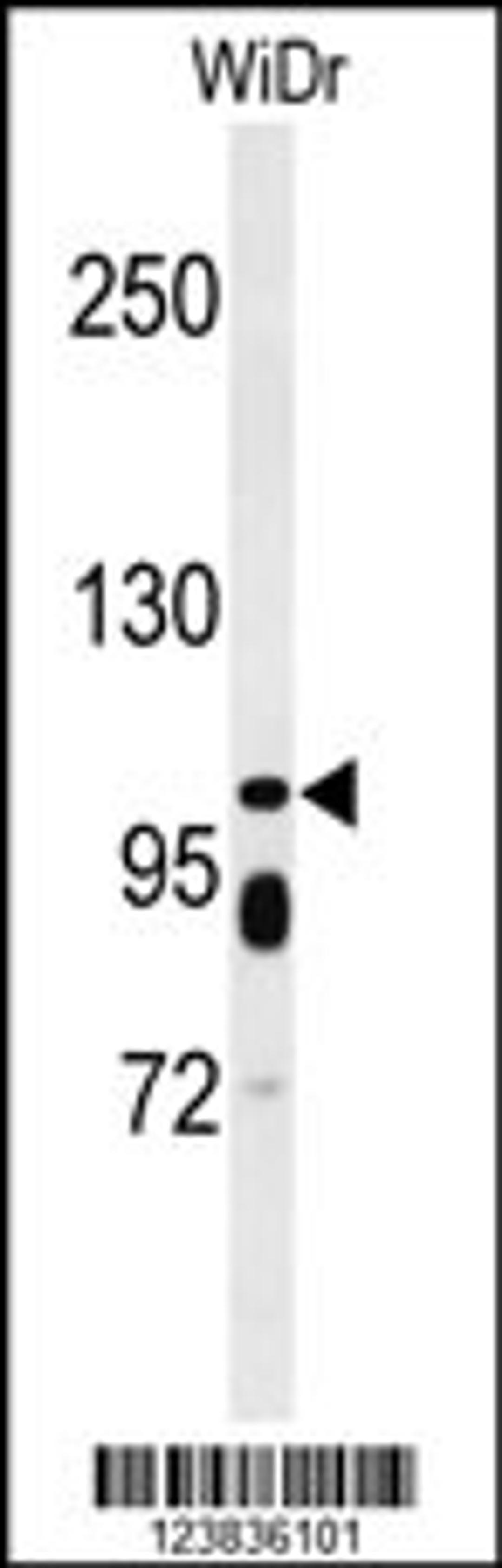 Western blot analysis of ABCC11 Antibody in WiDr cell line lysates (35ug/lane)