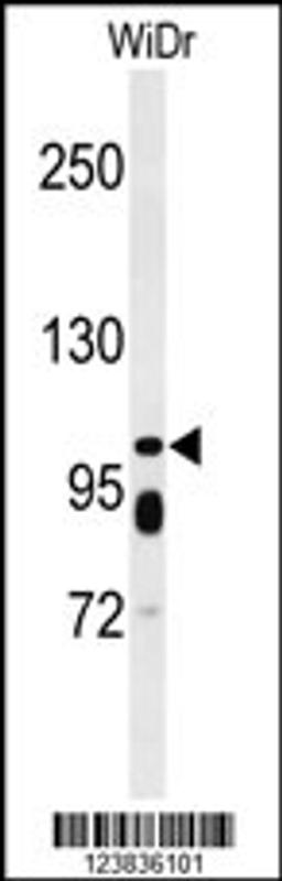 Western blot analysis of ABCC11 Antibody in WiDr cell line lysates (35ug/lane)