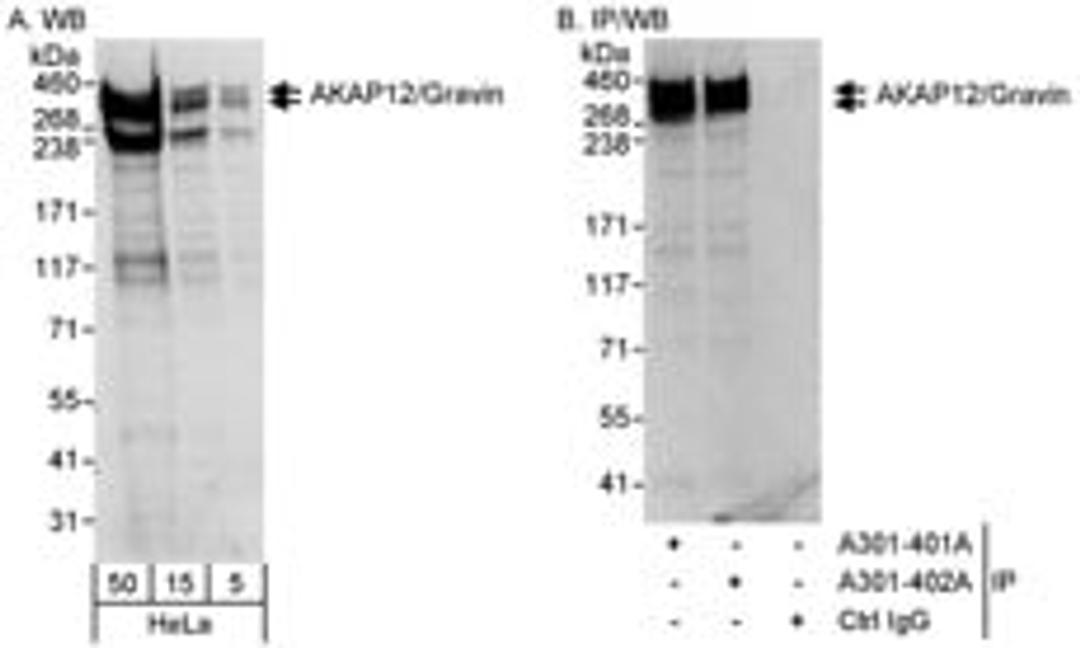 Detection of human AKAP12/Gravin by western blot and immunoprecipitation.