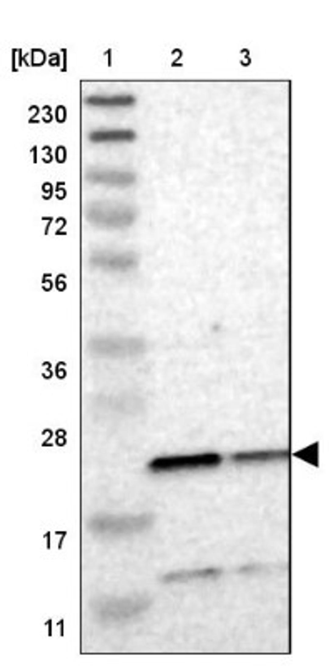 Western Blot: TMED2 Antibody [NBP1-80963] - Lane 1: Marker [kDa] 230, 130, 95, 72, 56, 36, 28, 17, 11<br/>Lane 2: Human cell line RT-4<br/>Lane 3: Human cell line U-251MG sp