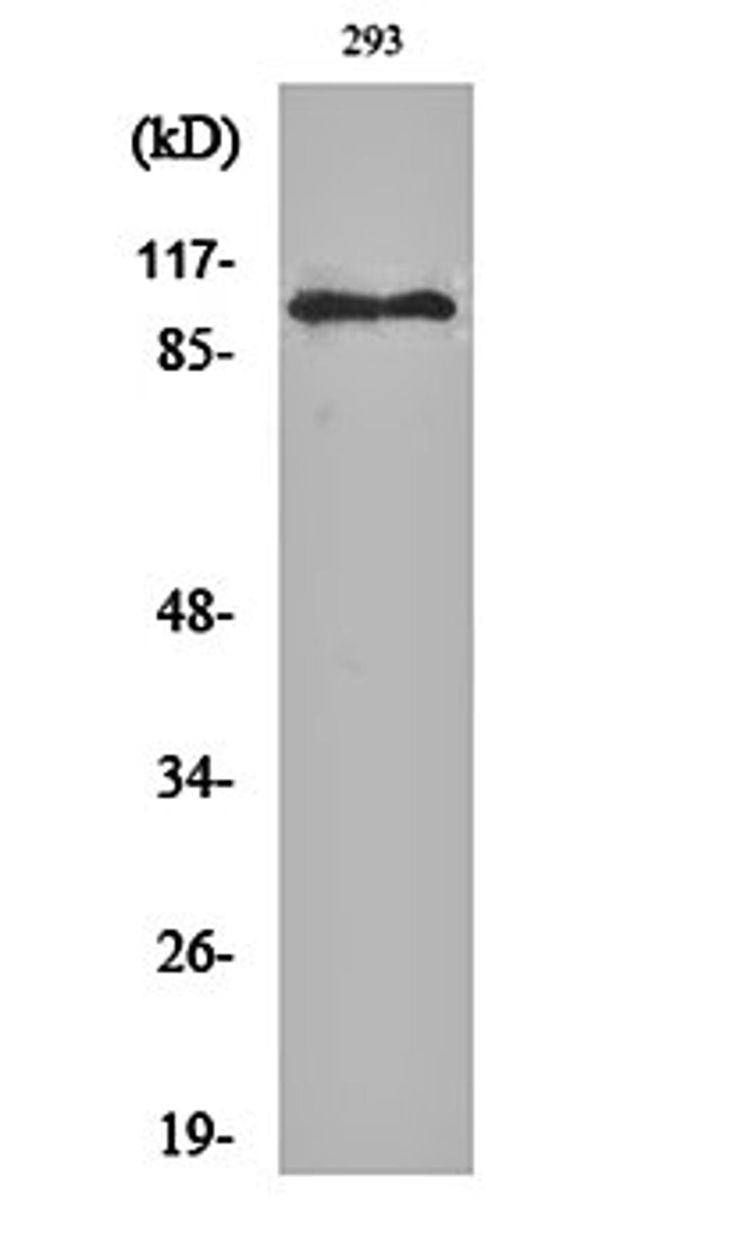 Western blot analysis of 293 cell lysates using ERCC4 antibody