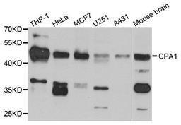 Western blot analysis of extracts of various cell lines using CPA1 antibody