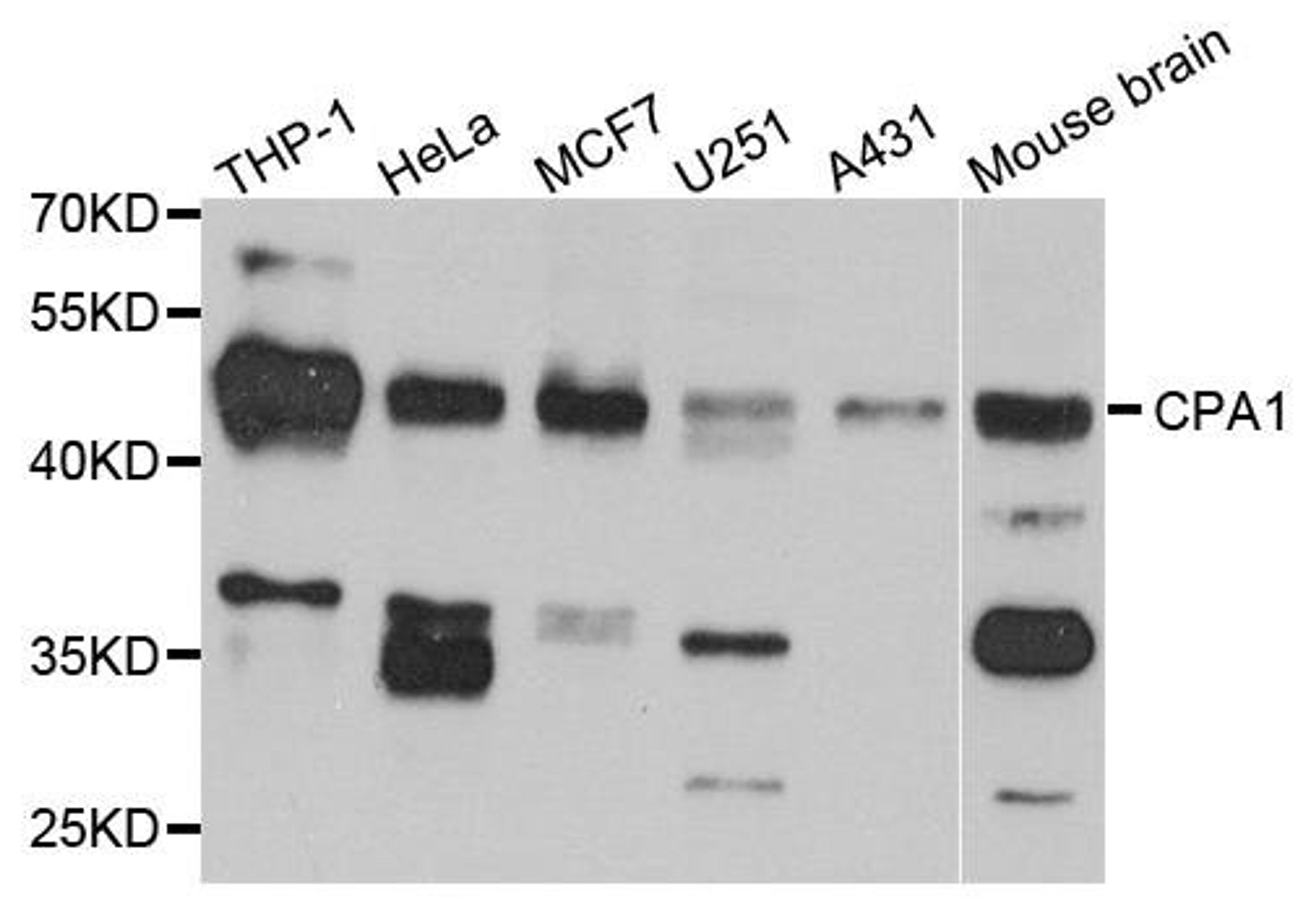 Western blot analysis of extracts of various cell lines using CPA1 antibody