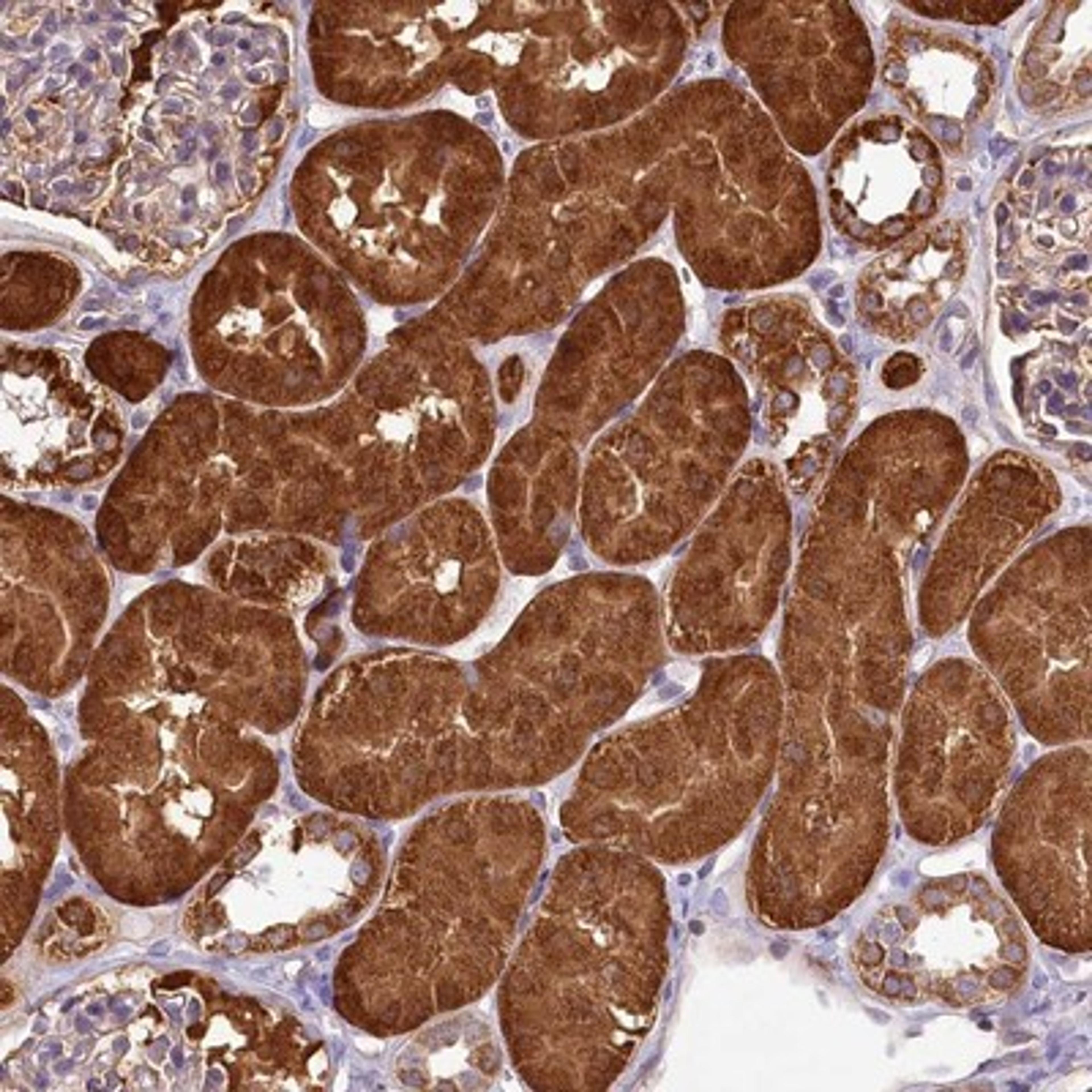 Immunohistochemistry-Paraffin: LMOD3 Antibody [NBP1-85898] - Staining of human kidney shows strong cytoplasmic positivity in cells in tubules of kidney.