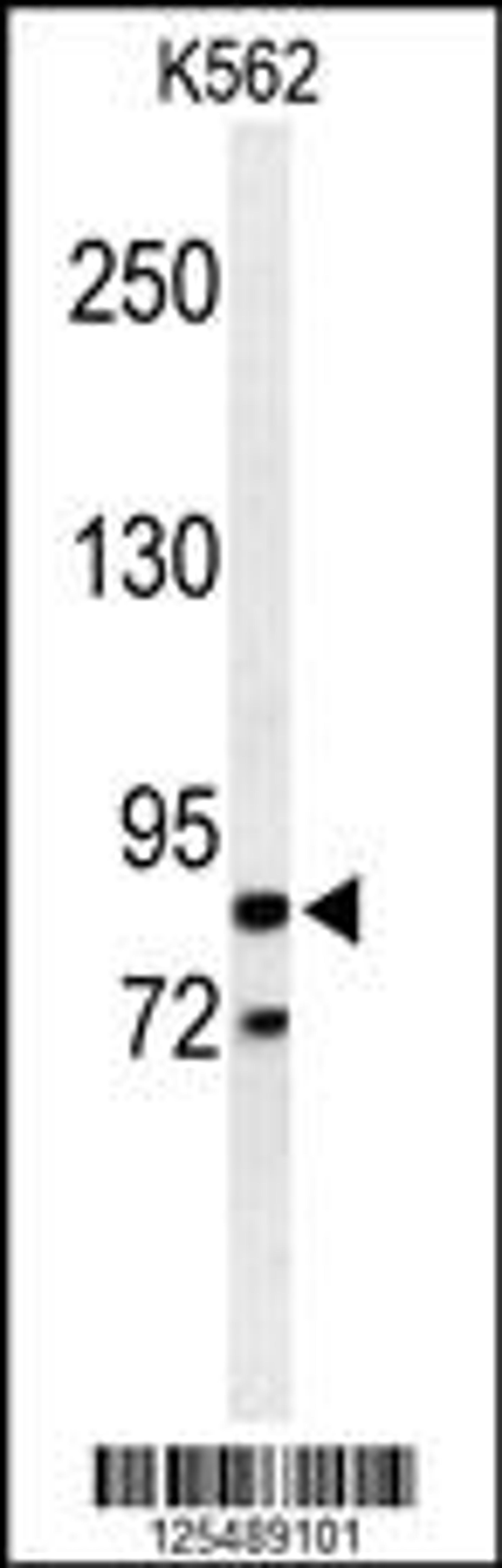 Western blot analysis of AVIL Antibody in K562 cell line lysates (35ug/lane)