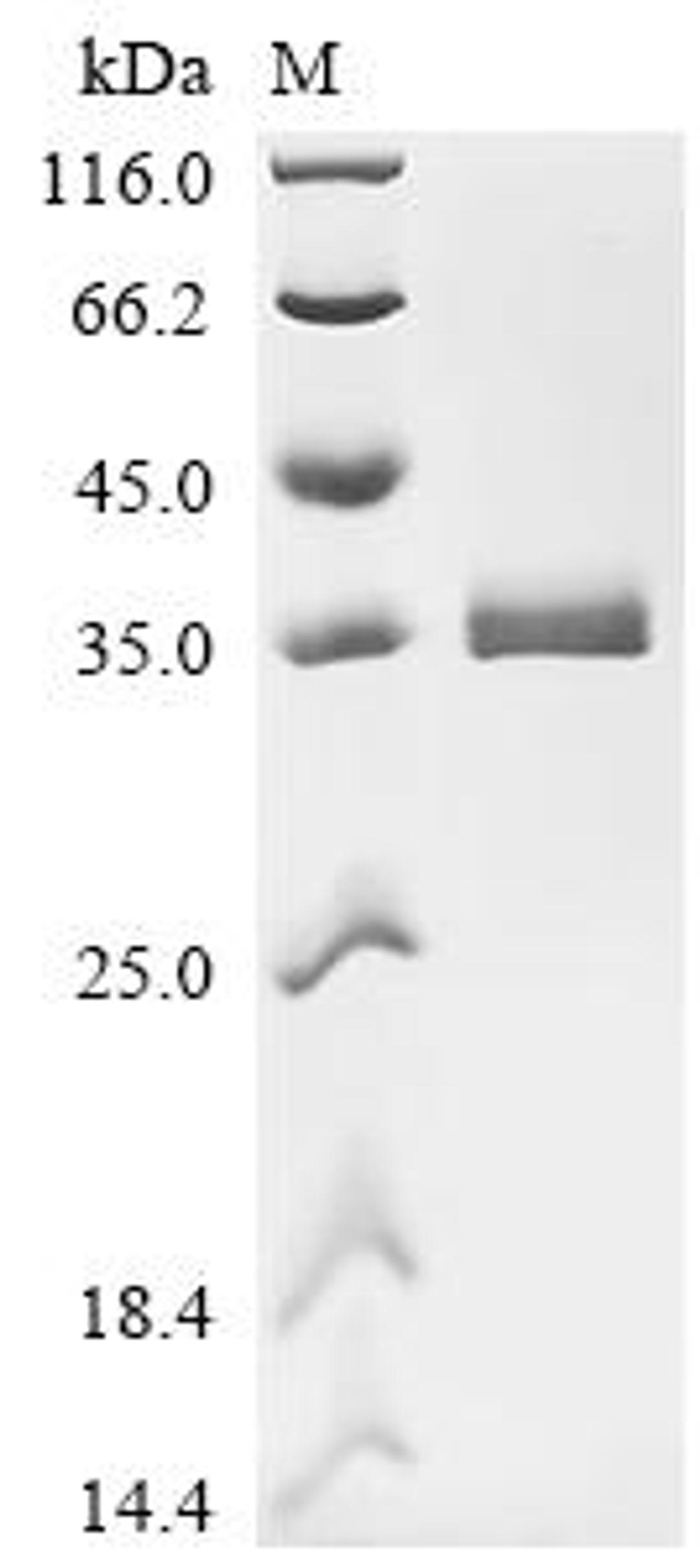(Tris-Glycine gel) Discontinuous SDS-PAGE (reduced) with 5% enrichment gel and 15% separation gel.