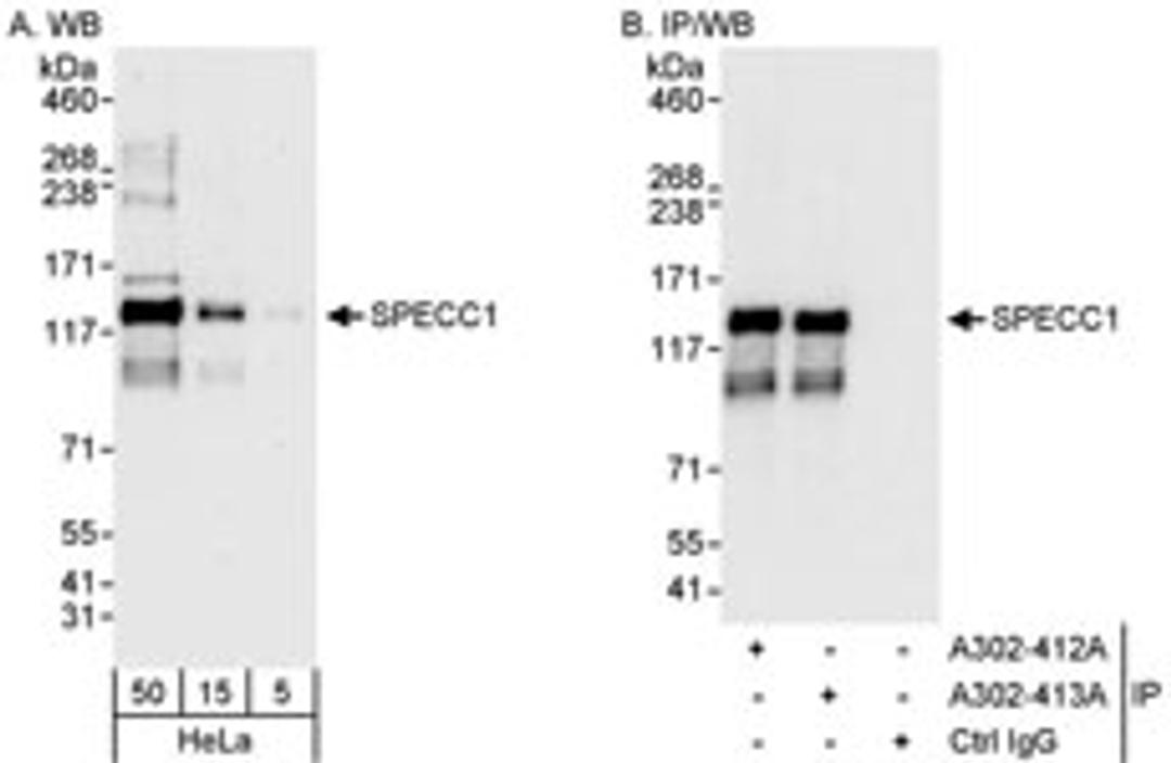 Detection of human SPECC1 by western blot and immunoprecipitation.