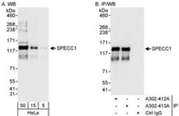 Detection of human SPECC1 by western blot and immunoprecipitation.