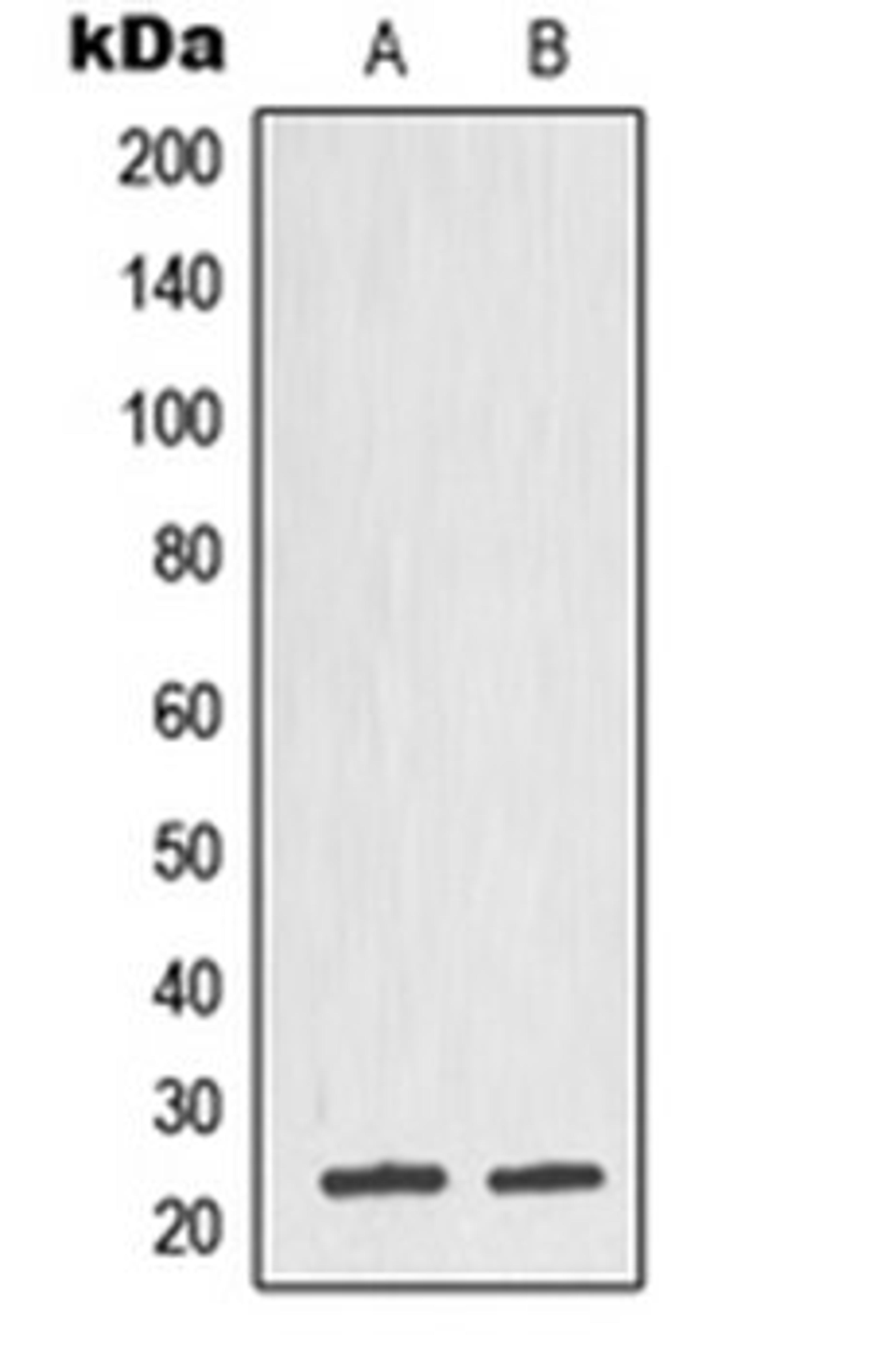 Western blot analysis of DU145 (Lane 1), CCRFCEM (Lane 2) whole cell lysates using TPT1 antibody