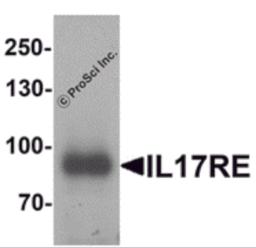 Western blot analysis of IL-17RE in human ovary tissue lysate with IL-17RE antibody at 1 &#956;g/mL.