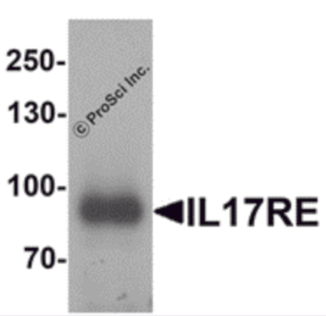 Western blot analysis of IL-17RE in human ovary tissue lysate with IL-17RE antibody at 1 μg/mL.