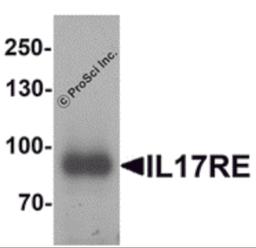 Western blot analysis of IL-17RE in human ovary tissue lysate with IL-17RE antibody at 1 μg/mL.
