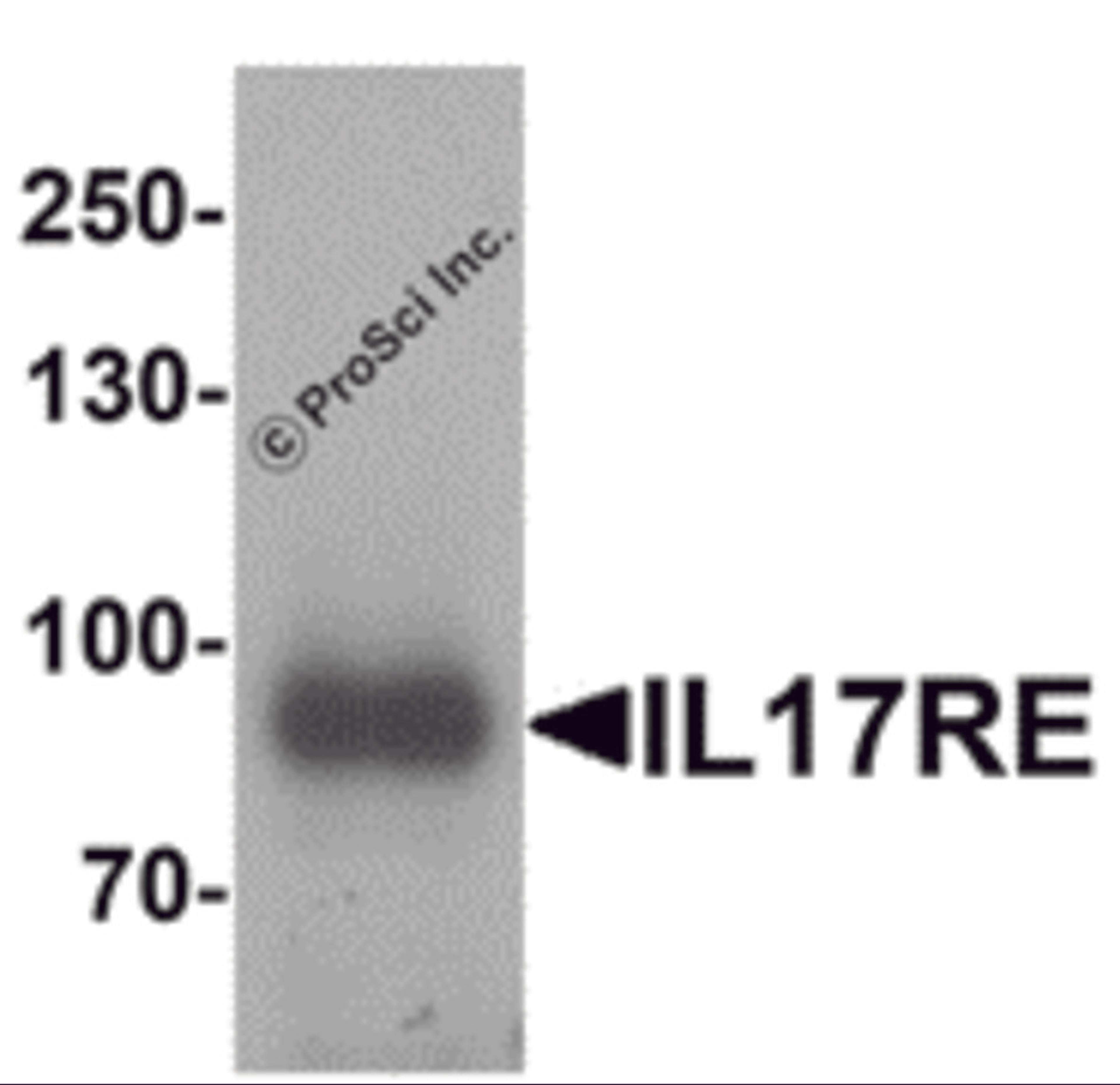 Western blot analysis of IL-17RE in human ovary tissue lysate with IL-17RE antibody at 1 μg/mL.