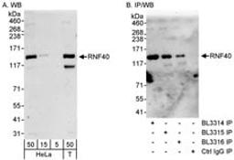 Detection of human RNF40 by western blot and immunoprecipitation.