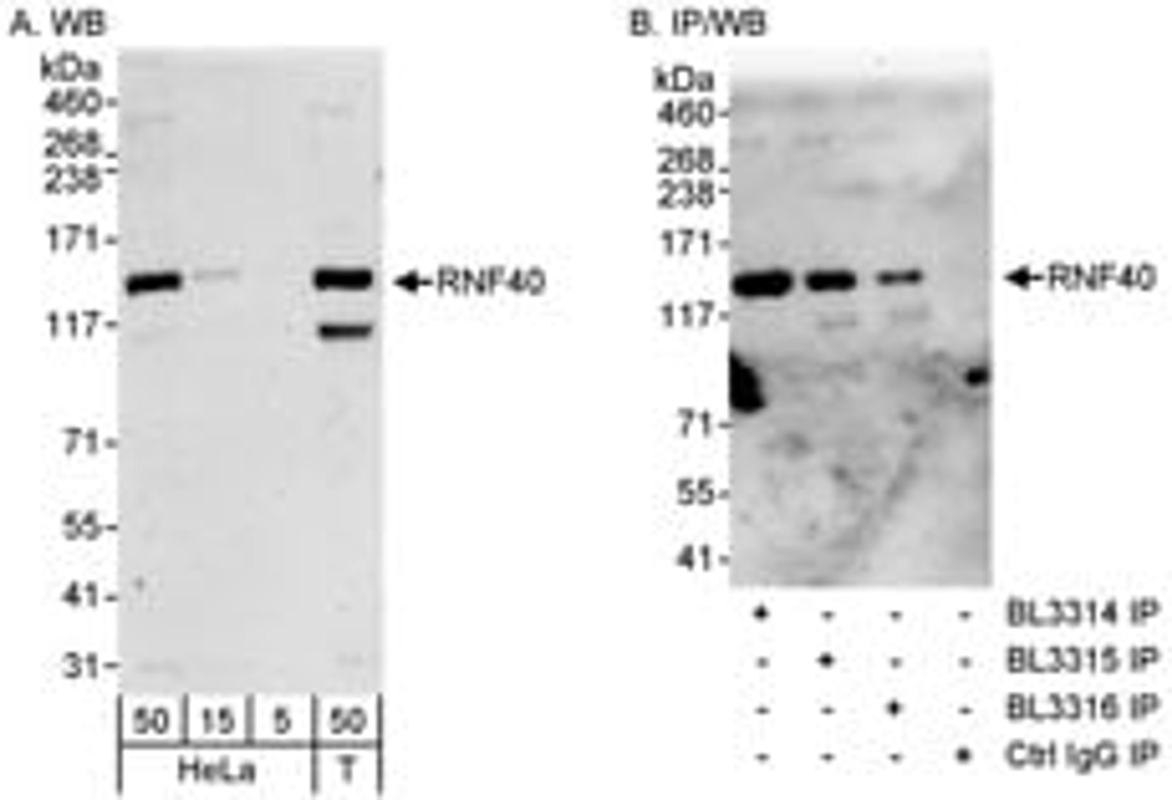 Detection of human RNF40 by western blot and immunoprecipitation.