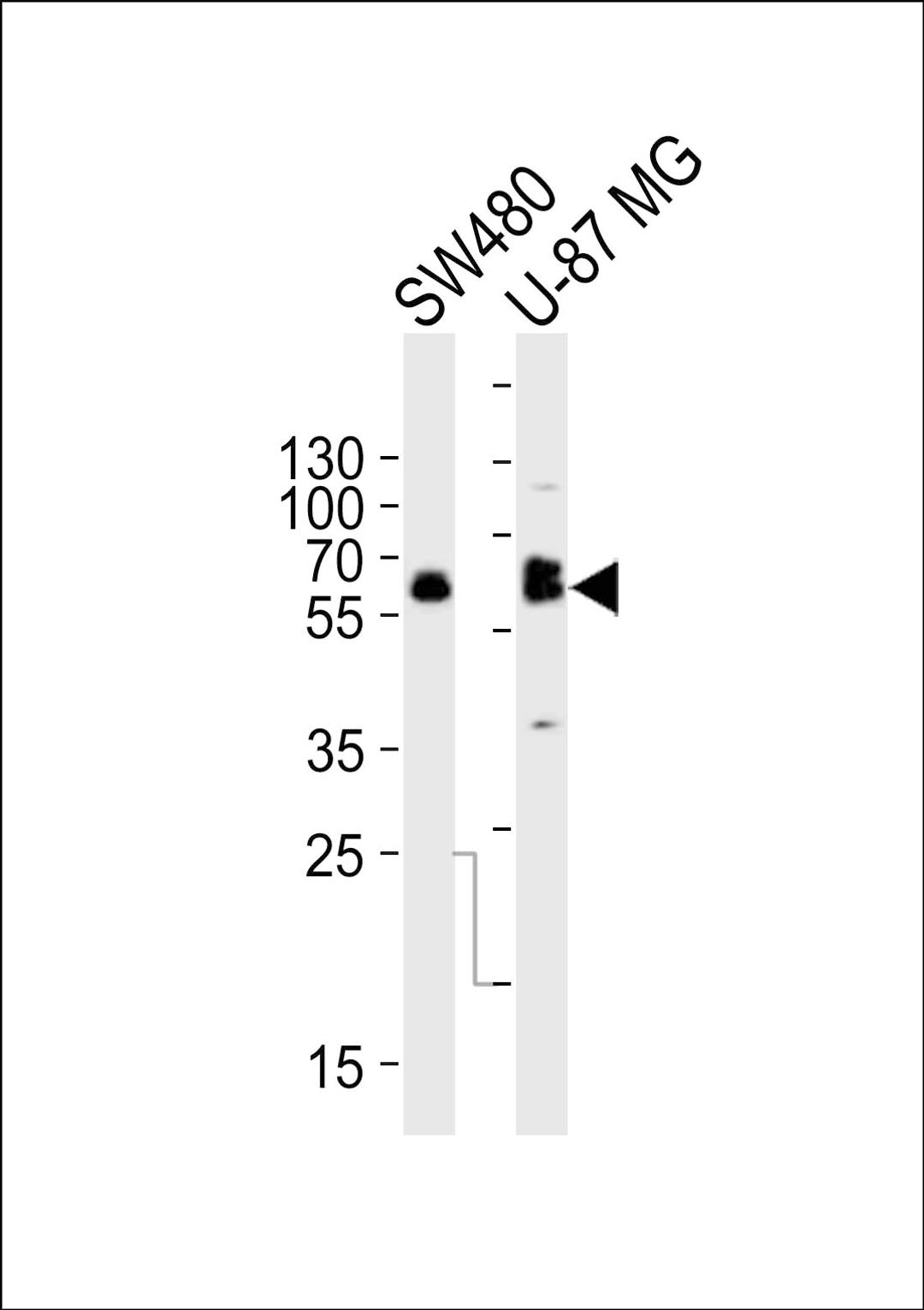 Western blot analysis of lysates from SW480, U-87 MG cell line (from left to right), using TH Antibody at 1:1000 at each lane.