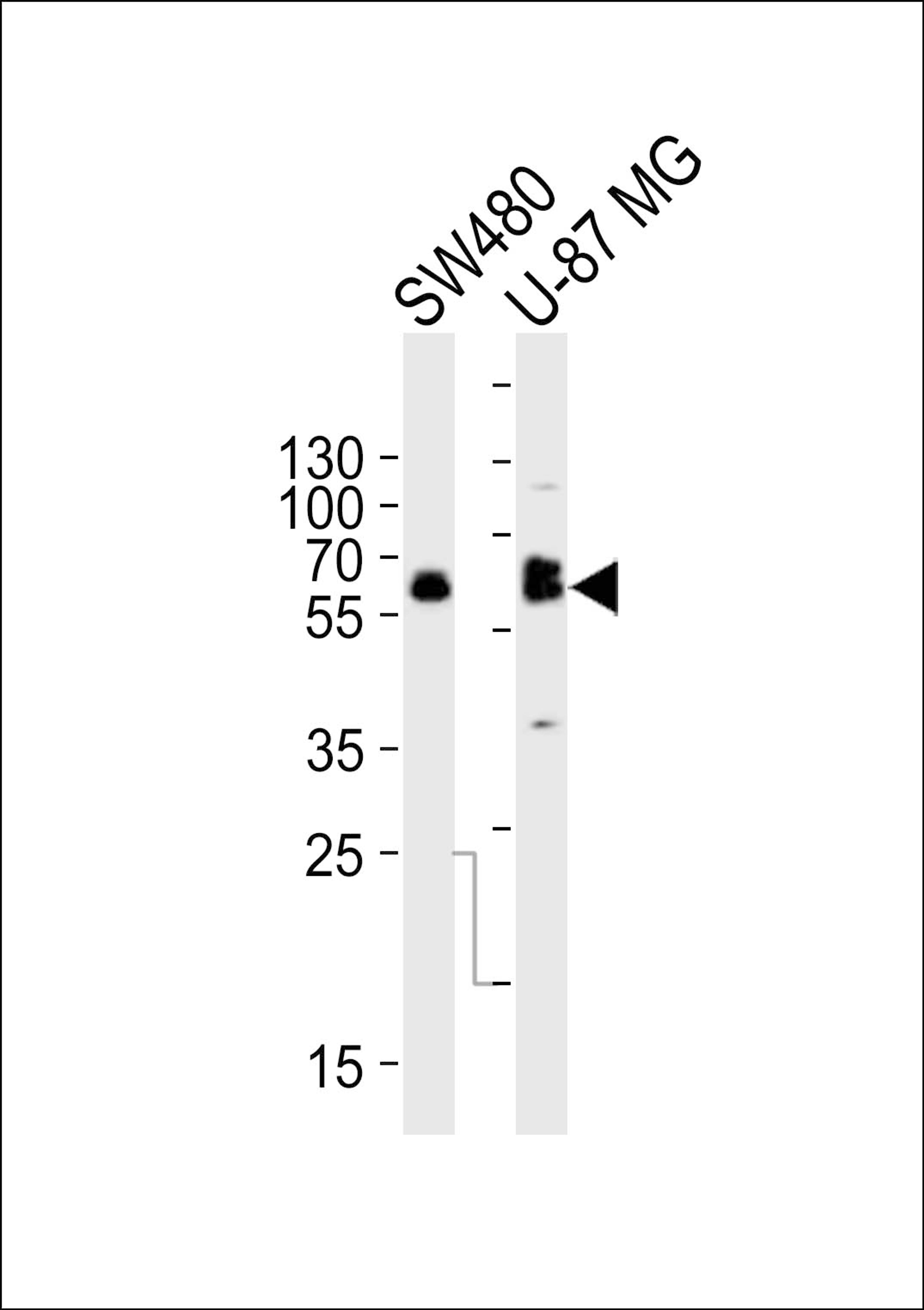 Western blot analysis of lysates from SW480, U-87 MG cell line (from left to right), using TH Antibody at 1:1000 at each lane.