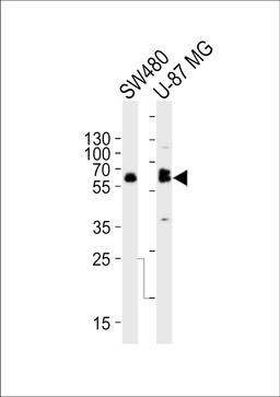Western blot analysis of lysates from SW480, U-87 MG cell line (from left to right), using TH Antibody at 1:1000 at each lane.