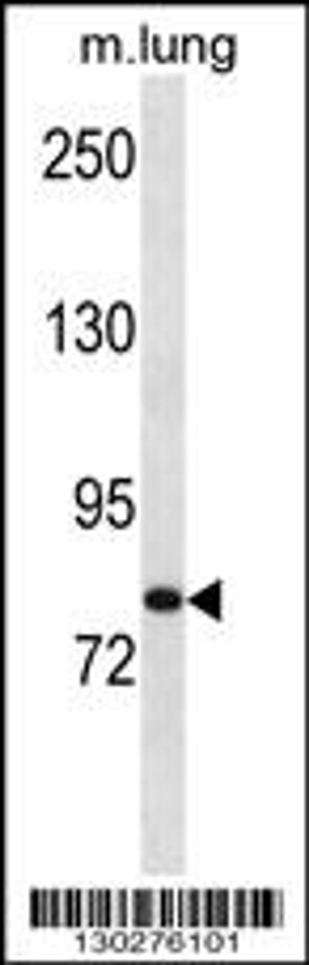 Western blot analysis in mouse lung tissue lysates (35ug/lane).