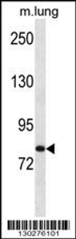 Western blot analysis in mouse lung tissue lysates (35ug/lane).